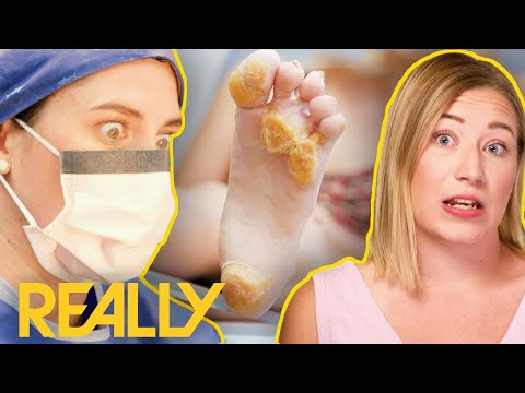 Ultra-Rare Condition With No Cure Treated With Revolutionary New Surgery | My Feet Are Killing Me